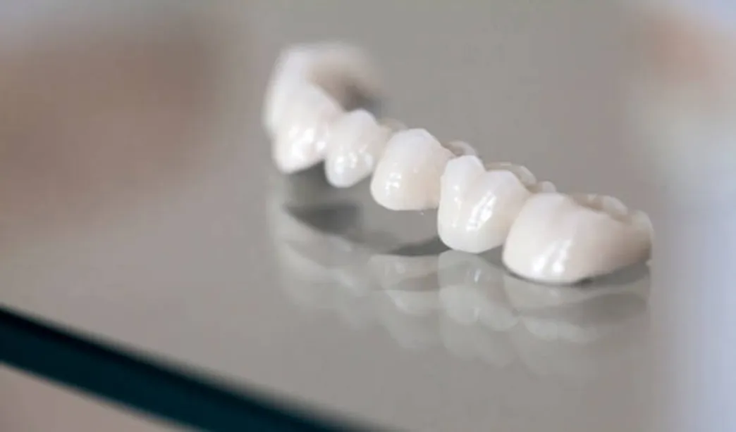 What are Polycarbonate Crowns in Pediatric Dentistry