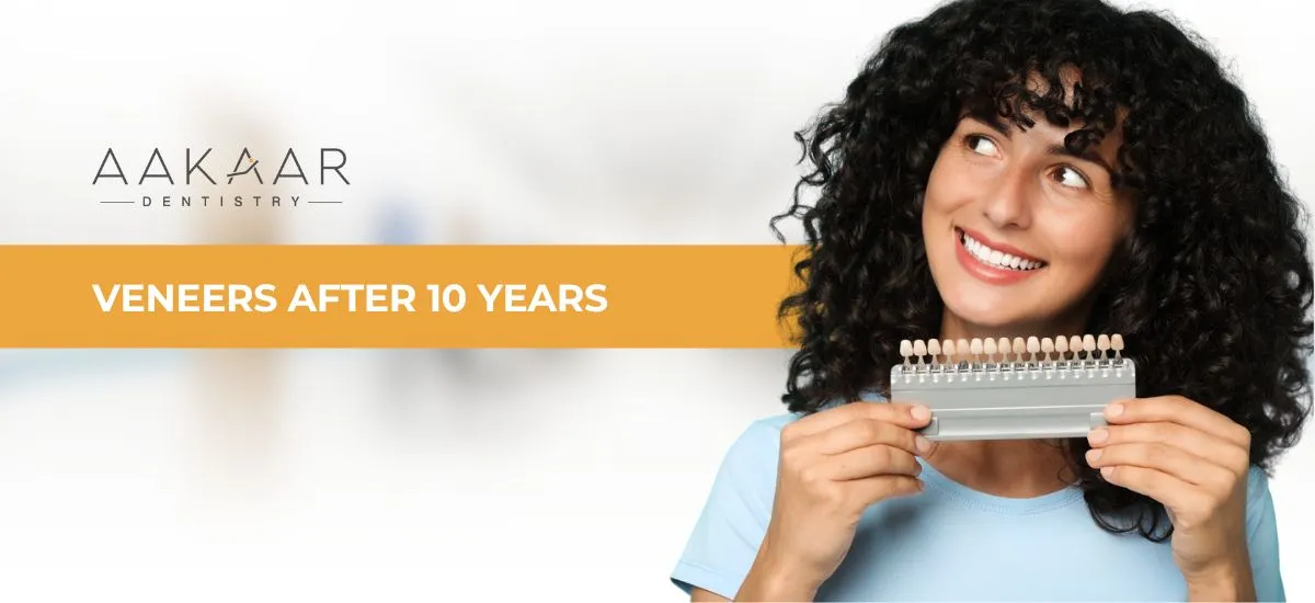 Veneers After 10 Years: What Can You Expect? 