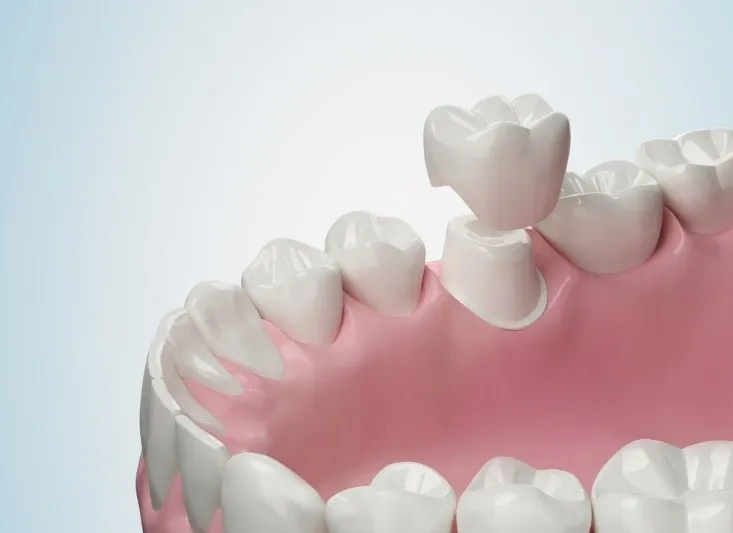 Is Cold Sensitivity Normal After a Crown?