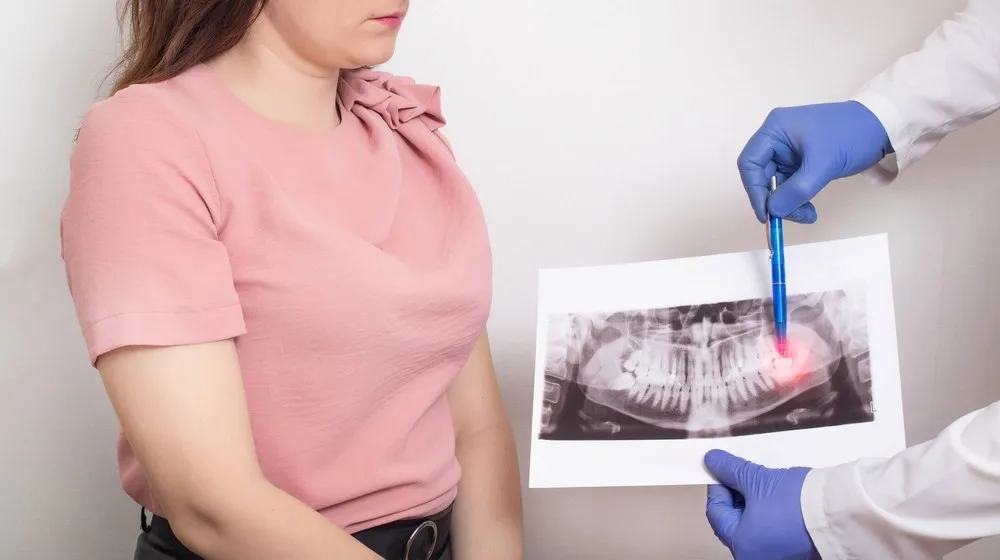 Gum Infection After Root Canal