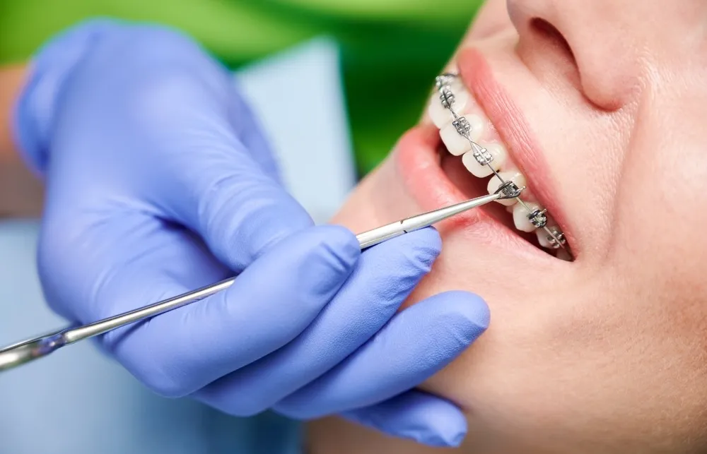 When should you Consult a Dentist?