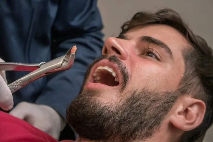 What Causes Jaw Pain After Wisdom Tooth Extraction?
