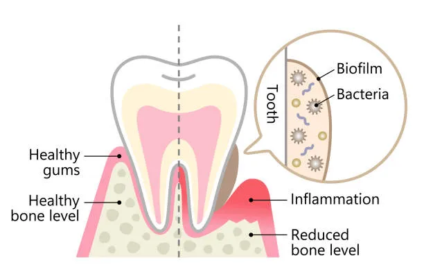 Potential Complications Related to Swelling