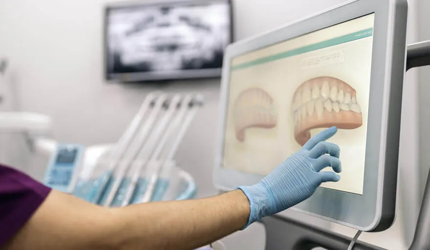 technology/digital-impressions-laser-dentistry.webp