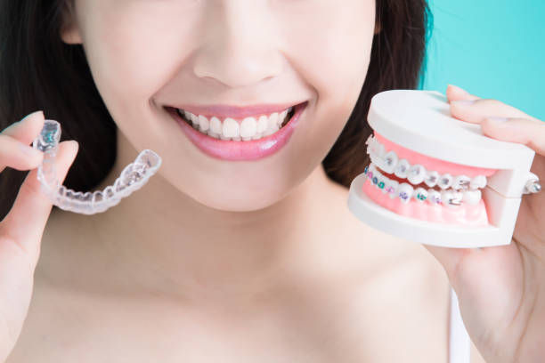Invisible Aligners Vs. Traditional Braces
