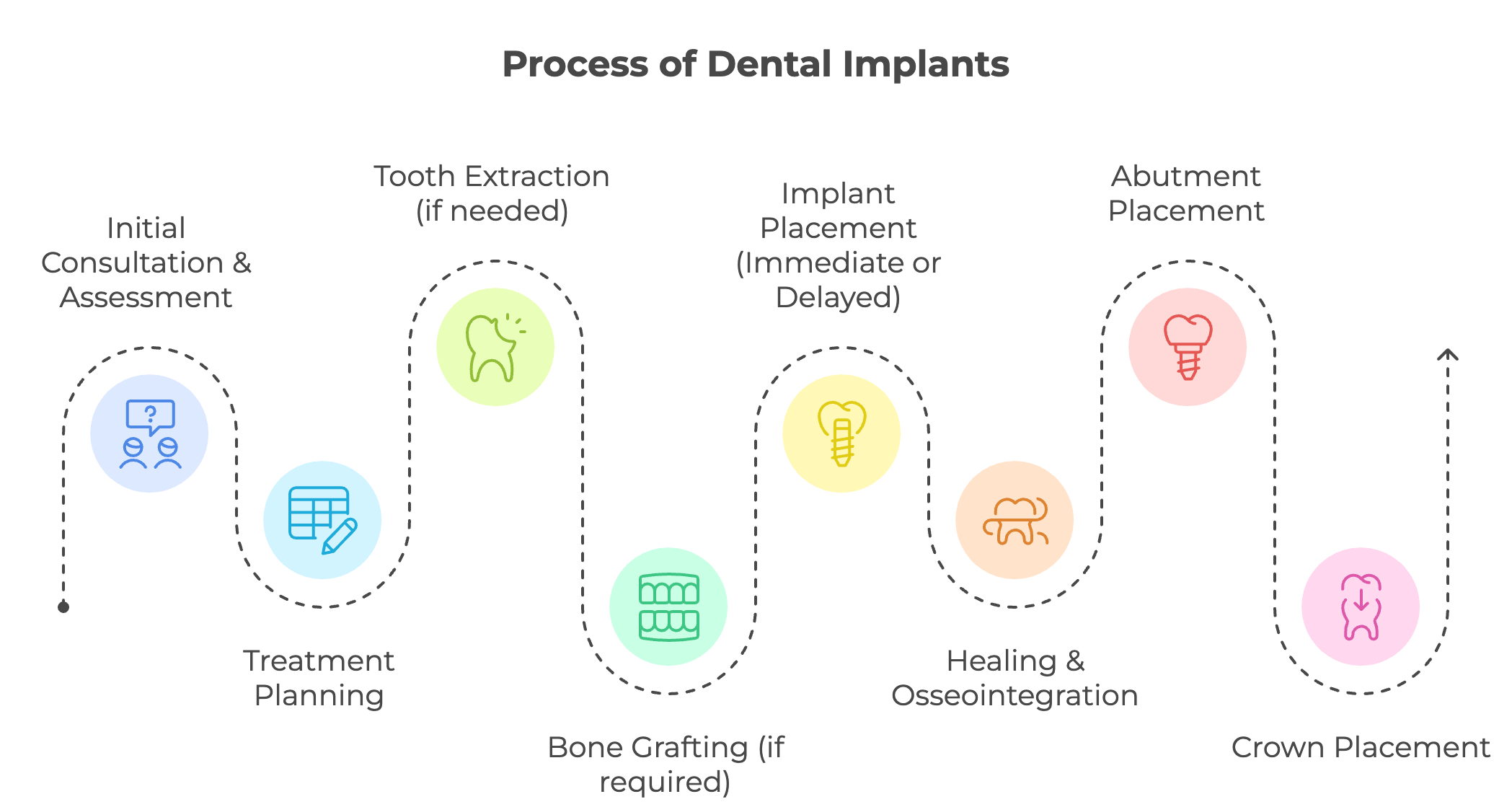 Process of Dental Implantation