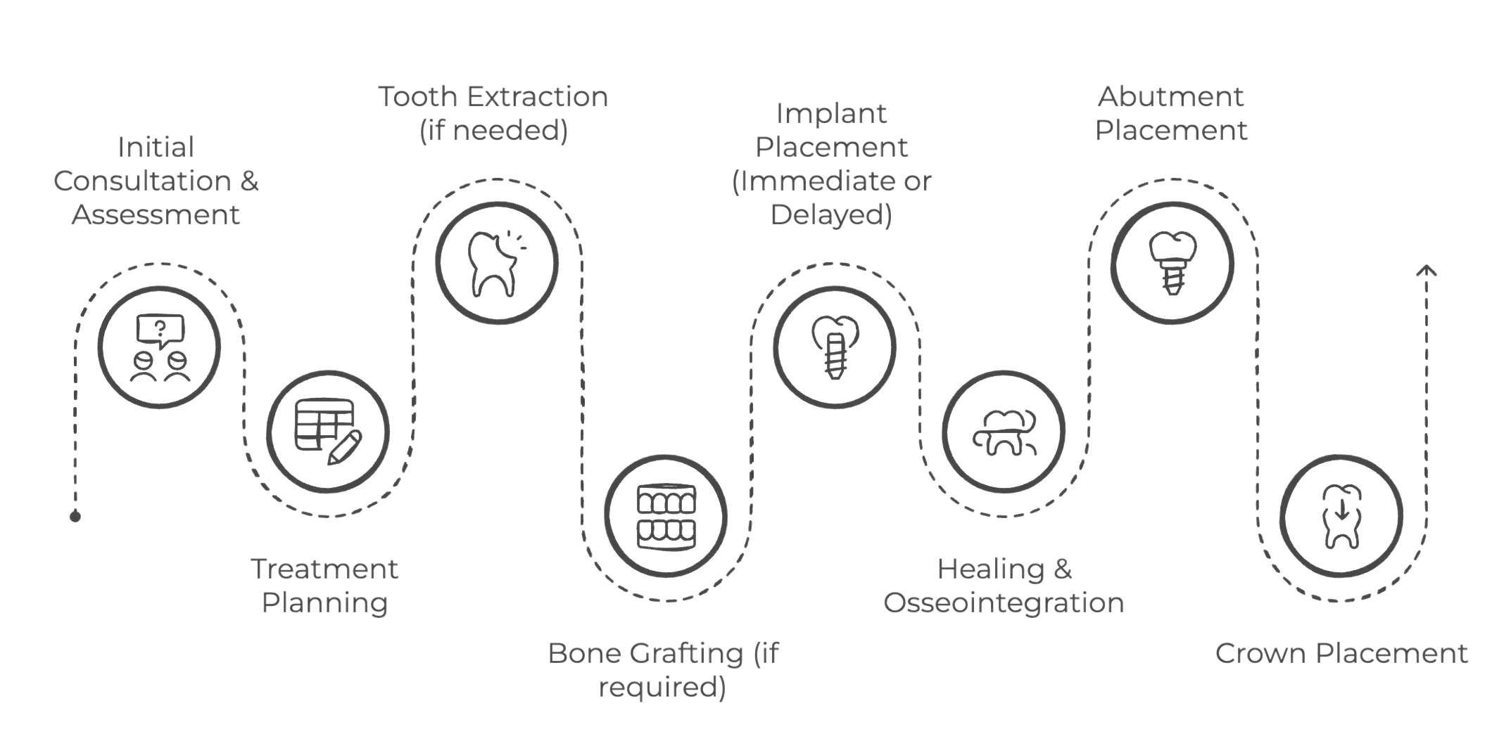 Process of Dental Implantation