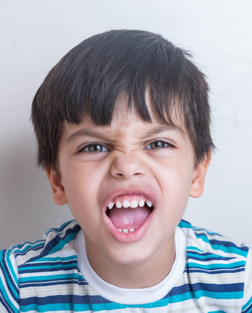 Need For Orthodontics